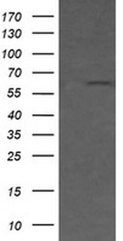 CD19 Monoclonal Antibody (OTI2G7), TrueMAB , OriGene 100 &mu;L; Unconjugated:Antibodies,