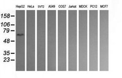 CD19 Monoclonal Antibody (OTI2G7), TrueMAB , OriGene 100 &mu;L; Unconjugated:Antibodies,