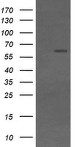 CD19 Monoclonal Antibody (OTI1F9), TrueMAB , OriGene:Antibodies:Primary