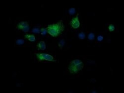 CD1C Mouse anti-Human, Clone: OTI1H9, lyophilized, TrueMAB 100 &mu;g; Unconjugated:Antibodies,