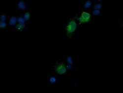CD1C Monoclonal Antibody (OTI1F4), TrueMAB , OriGene 30 &mu;L; Unconjugated:Antibodies,