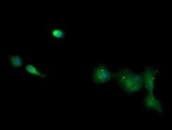 CD1C Monoclonal Antibody (OTI5A8), TrueMAB , OriGene:Antibodies:Primary