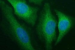 CD1C Monoclonal Antibody (OTI5A8), TrueMAB , OriGene 30 &mu;L; Unconjugated:Antibodies,