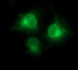 CD1C Monoclonal Antibody (OTI2F1), TrueMAB , OriGene 100 &mu;L; Unconjugated:Antibodies,