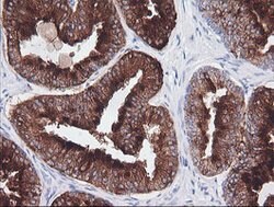 CD1C Mouse anti-Human, Clone: OTI1H9, lyophilized, TrueMAB 100 &mu;g; Unconjugated:Antibodies,