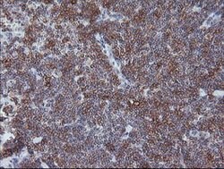 CD1C Mouse anti-Human, Clone: OTI1H9, lyophilized, TrueMAB 100 &mu;g; Unconjugated:Antibodies,