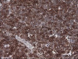 CD1C Monoclonal Antibody (OTI1F4), TrueMAB , OriGene 30 &mu;L; Unconjugated:Antibodies,