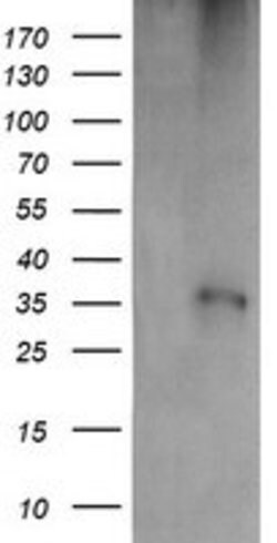 CD1C Mouse anti-Human, Clone: OTI1H9, lyophilized, TrueMAB 100 &mu;g; Unconjugated:Antibodies,