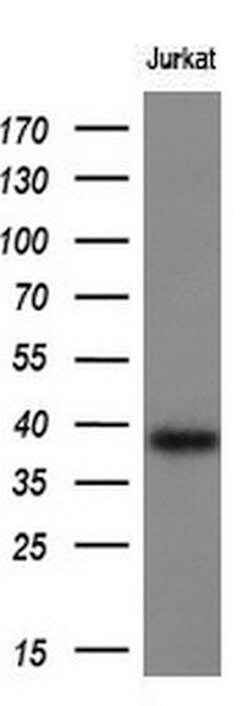 CD1C Mouse anti-Human, Clone: OTI1H9, lyophilized, TrueMAB 100 &mu;g; Unconjugated:Antibodies,
