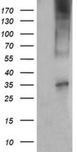 CD1C Monoclonal Antibody (OTI1F4), TrueMAB , OriGene 30 &mu;L; Unconjugated:Antibodies,