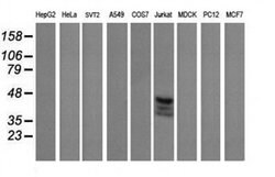 CD1C Monoclonal Antibody (OTI1F4), TrueMAB , OriGene 30 &mu;L; Unconjugated:Antibodies,