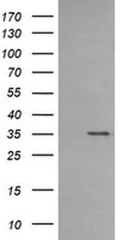 CD1C Monoclonal Antibody (OTI5A8), TrueMAB , OriGene 30 &mu;L; Unconjugated:Antibodies,
