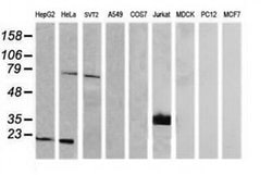 CD1C Monoclonal Antibody (OTI5A8), TrueMAB , OriGene 30 &mu;L; Unconjugated:Antibodies,