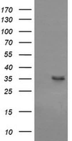 CD1C Monoclonal Antibody (OTI2F1), TrueMAB , OriGene 100 &mu;L; Unconjugated:Antibodies,