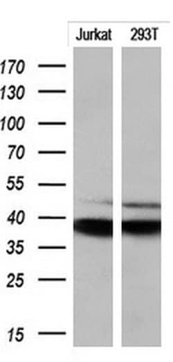 CD1C Monoclonal Antibody (OTI2F1), TrueMAB , OriGene 100 &mu;L; Unconjugated:Antibodies,