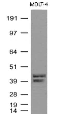 CD1C Mouse anti-Human, Clone: UMAB46, liquid, UltraMAB 100 &mu;L; Unconjugated:Antibodies,