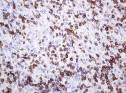 CD2 Monoclonal Antibody (OTI3E11), TrueMAB , OriGene 30 &mu;L; Unconjugated:Antibodies,