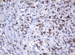 CD2 Mouse anti-Human, Clone: OTI5A1, lyophilized, TrueMAB 100 &mu;g; Unconjugated:Antibodies,