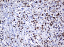 CD2 Monoclonal Antibody (OTI5A1), TrueMAB , OriGene 100 &mu;L; Unconjugated:Antibodies,