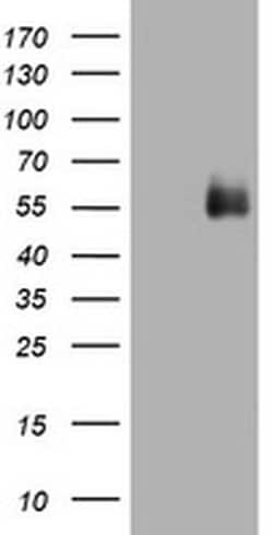 CD2 Monoclonal Antibody (OTI3E11), TrueMAB , OriGene 30 &mu;L; Unconjugated:Antibodies,