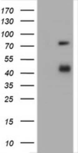 CD2 Mouse anti-Human, Clone: OTI1D4, lyophilized, TrueMAB 100 &mu;g; Unconjugated:Antibodies,