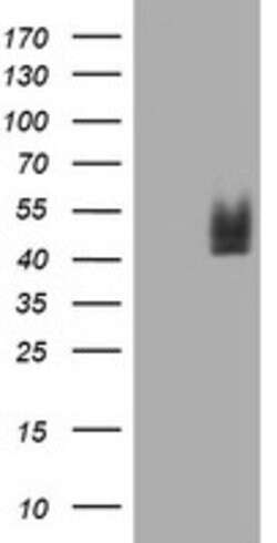 CD2 Mouse anti-Human, Clone: OTI2C3, lyophilized, TrueMAB 100 &mu;g; Unconjugated:Antibodies,