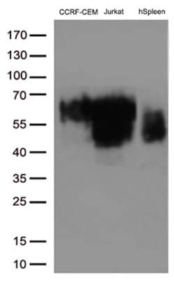 CD2 Mouse anti-Human, Clone: OTI2C3, lyophilized, TrueMAB 100 &mu;g; Unconjugated:Antibodies,
