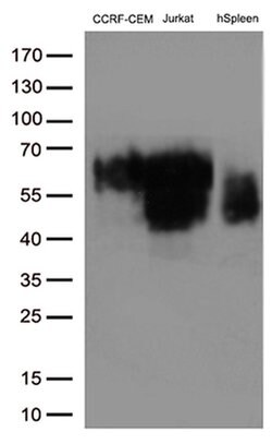 CD2 Monoclonal Antibody (OTI2C3), TrueMAB , OriGene 100 &mu;L; Unconjugated:Antibodies,