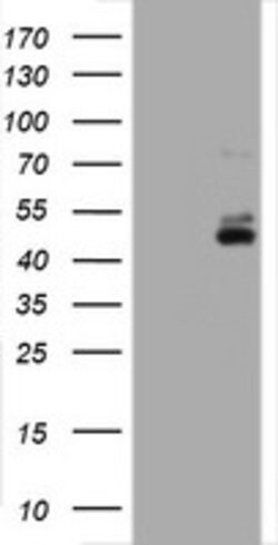 CD2 Mouse anti-Human, Clone: OTI5A1, lyophilized, TrueMAB 100 &mu;g; Unconjugated:Antibodies,