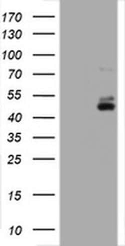 CD2 Monoclonal Antibody (OTI5A1), TrueMAB , OriGene:Antibodies:Primary