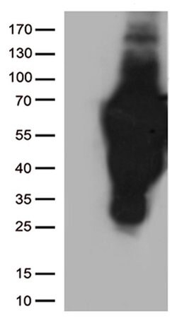 CD2 Mouse anti-Human, Clone: UMAB86, liquid, UltraMAB 30 &mu;L; Unconjugated:Antibodies,