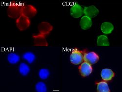 CD20 (MS4A1) Mouse anti-Human, Clone: UMAB58, liquid, UltraMAB 100 &mu;L;