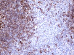 CD20 (MS4A1) Monoclonal Antibody (OTI4B4), TrueMAB , OriGene:Antibodies:Primary