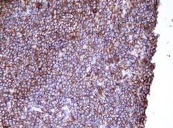 CD20 (MS4A1) Monoclonal Antibody (OTI1H4), TrueMAB , OriGene 100 &mu;L;