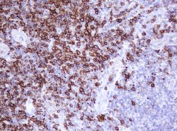 CD20 (MS4A1) Monoclonal Antibody (OTI1H4), TrueMAB , OriGene 100 &mu;L;