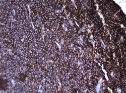 CD20 (MS4A1) Mouse anti-Human, Clone: OTI3C4, lyophilized, TrueMAB 100