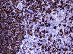 CD20 (MS4A1) Mouse anti-Human, Clone: OTI3C4, lyophilized, TrueMAB 100