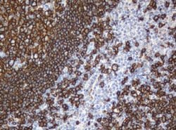 CD20 (MS4A1) Monoclonal Antibody (OTI2D3), TrueMAB , OriGene 100 &mu;L;