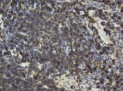 CD20 (MS4A1) Monoclonal Antibody (OTI4A4), TrueMAB , OriGene 100 &mu;L;
