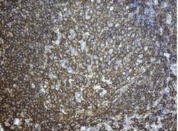 CD20 (MS4A1) Monoclonal Antibody (OTI11F7), TrueMAB , OriGene 100 &mu;L;