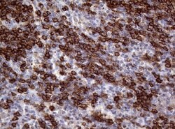 CD20 (MS4A1) Monoclonal Antibody (OTI11F7), TrueMAB , OriGene 100 &mu;L;