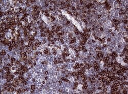 CD20 (MS4A1) Monoclonal Antibody (OTI11F7), TrueMAB , OriGene 100 &mu;L;