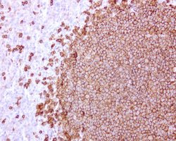 CD20 (MS4A1) Mouse anti-Human, Clone: UMAB38, lyophilized, UltraMAB 100
