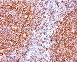 CD20 (MS4A1) Mouse anti-Human, Clone: UMAB38, lyophilized, UltraMAB 100