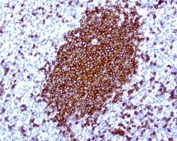 CD20 (MS4A1) Mouse anti-Human, Clone: UMAB39, lyophilized, UltraMAB 100