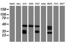 CD20 (MS4A1) Monoclonal Antibody (OTI4B4), TrueMAB , OriGene 100 &mu;L;