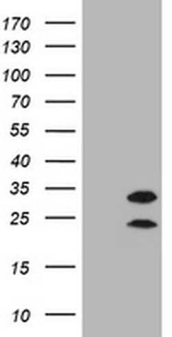 CD20 (MS4A1) Monoclonal Antibody (OTI2D3), TrueMAB , OriGene 100 &mu;L;