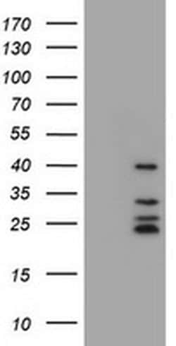 CD20 (MS4A1) Monoclonal Antibody (OTI4A4), TrueMAB , OriGene 100 &mu;L;