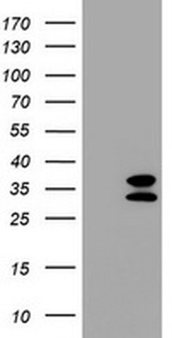CD20 (MS4A1) Monoclonal Antibody (OTI11F7), TrueMAB , OriGene 100 &mu;L;
