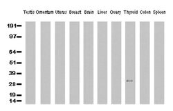 CD20 (MS4A1) Mouse anti-Human, Clone: UMAB38, lyophilized, UltraMAB 100